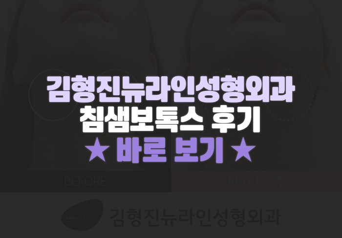 침샘보톡스 신중한 선택은 김형진원장 관련 이미지 6