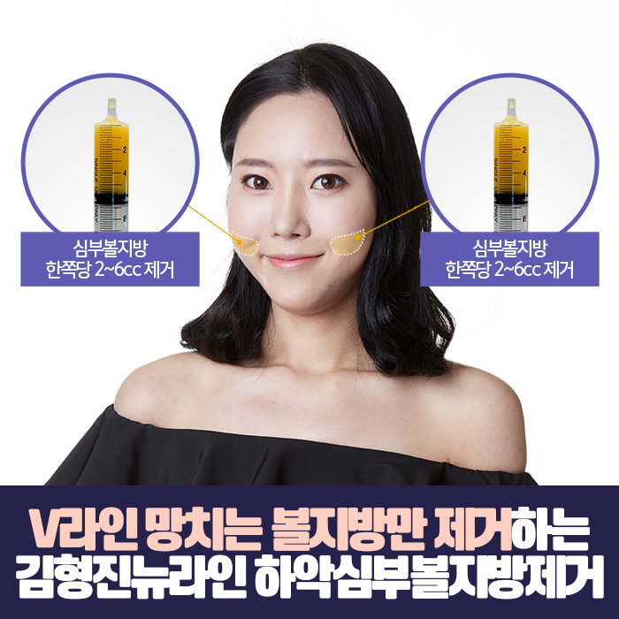 불독살 리프팅으론 안된다구요 관련 이미지 5
