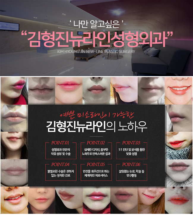 입꼬리성형전후 확인 내가 소유하고싶다! 관련 이미지 4