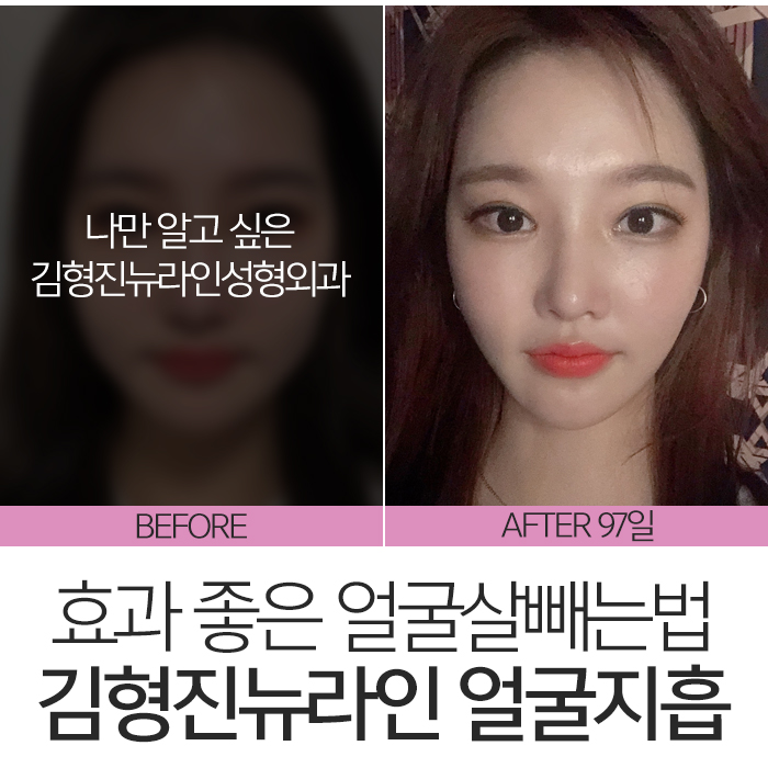 얼굴살빼는법 알아보고 있었다면? 관련 이미지 7