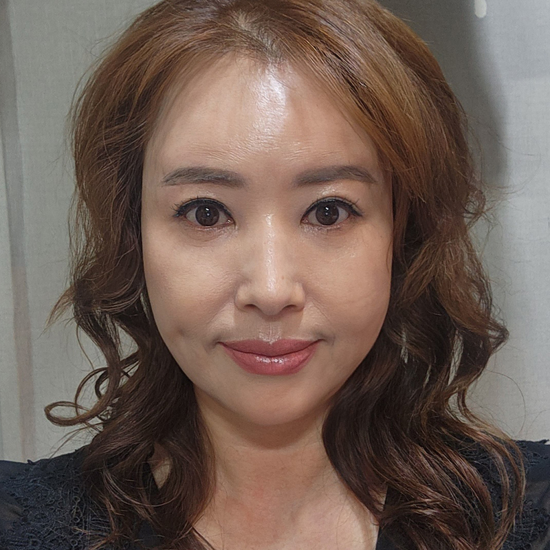 중년눈밑지방개선 어떤 방법이 있냐구요? 관련 이미지 1