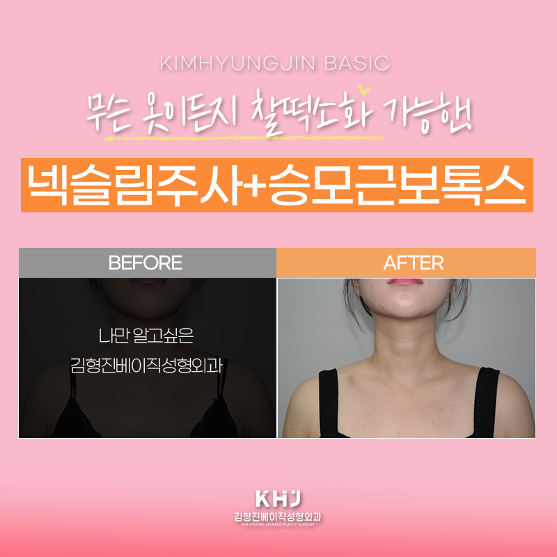 웨딩관리로 입소문 난 시술 궁금하셨다면? 관련 이미지 5