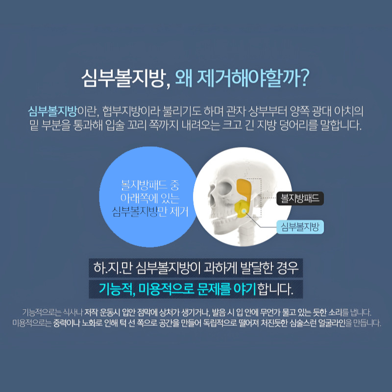 얼지흡후기 처음으로 턱선 봤어요ㅠㅠ 관련 이미지 4