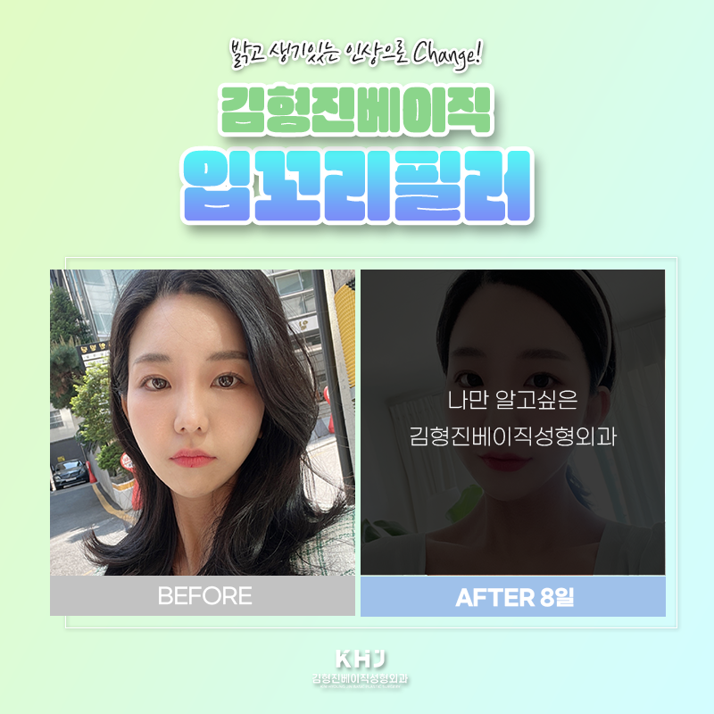 입꼬리올리는법 궁금하셨죠? 관련 이미지 5