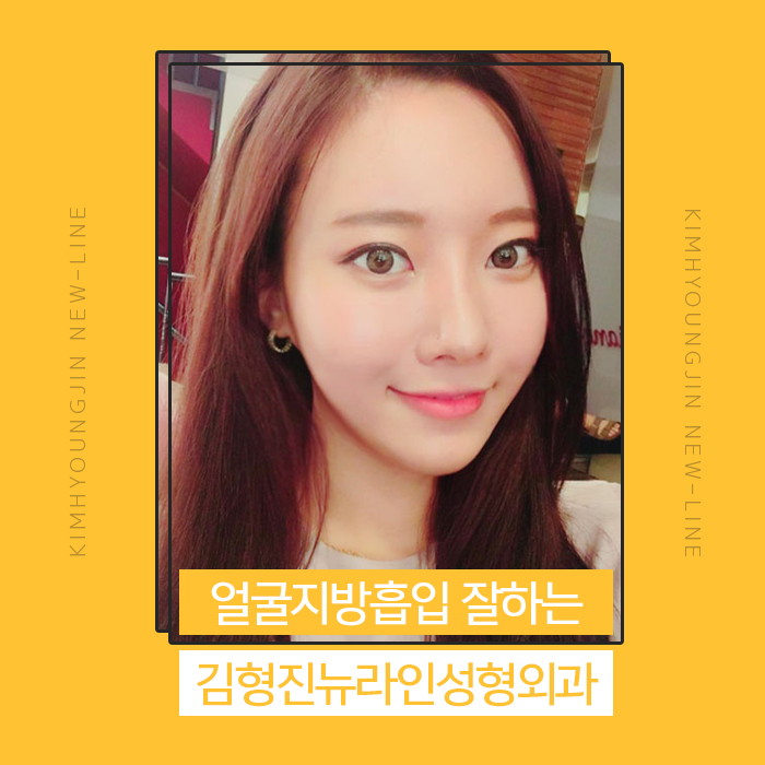 얼굴지방흡입붓기 요즘 누가 걱정해? 관련 이미지 1
