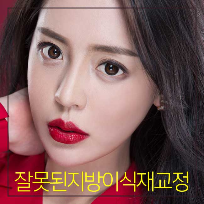 지방이식재수술 김형진에서 해결하자! 관련 이미지 2