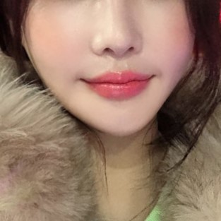 역대급 강남입꼬리필러후기 보고 갈 사람? 관련 이미지 4