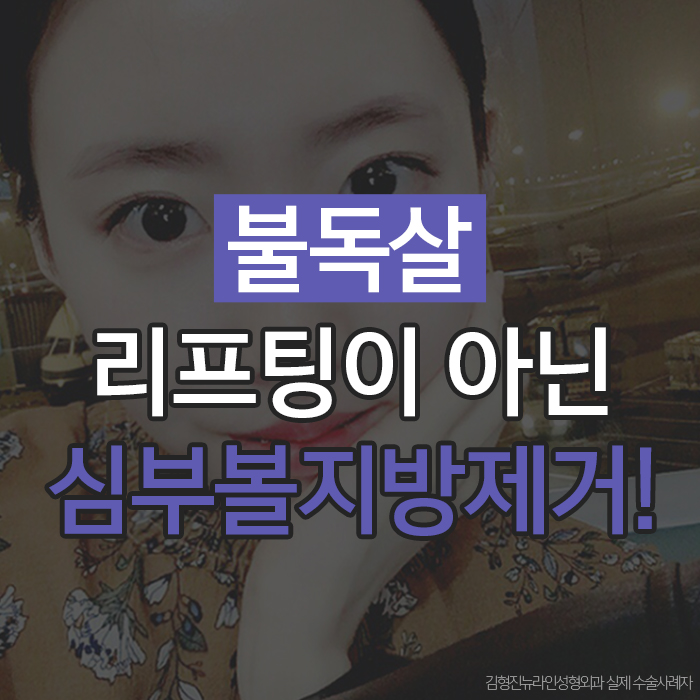 불독살 리프팅으론 안된다구요 관련 이미지 1