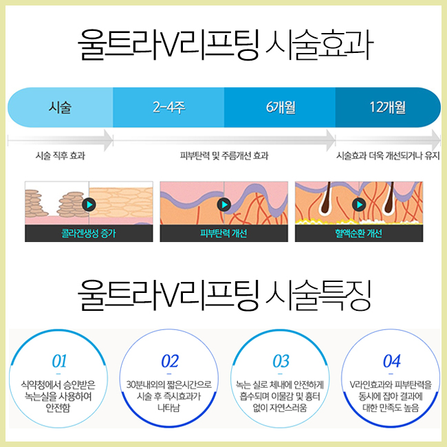 턱살리프팅으로 처진 살 얼른 올리자!~ 관련 이미지 3