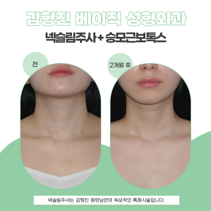 시간 없을 때 빠르게 목길어지는법 관련 이미지 5