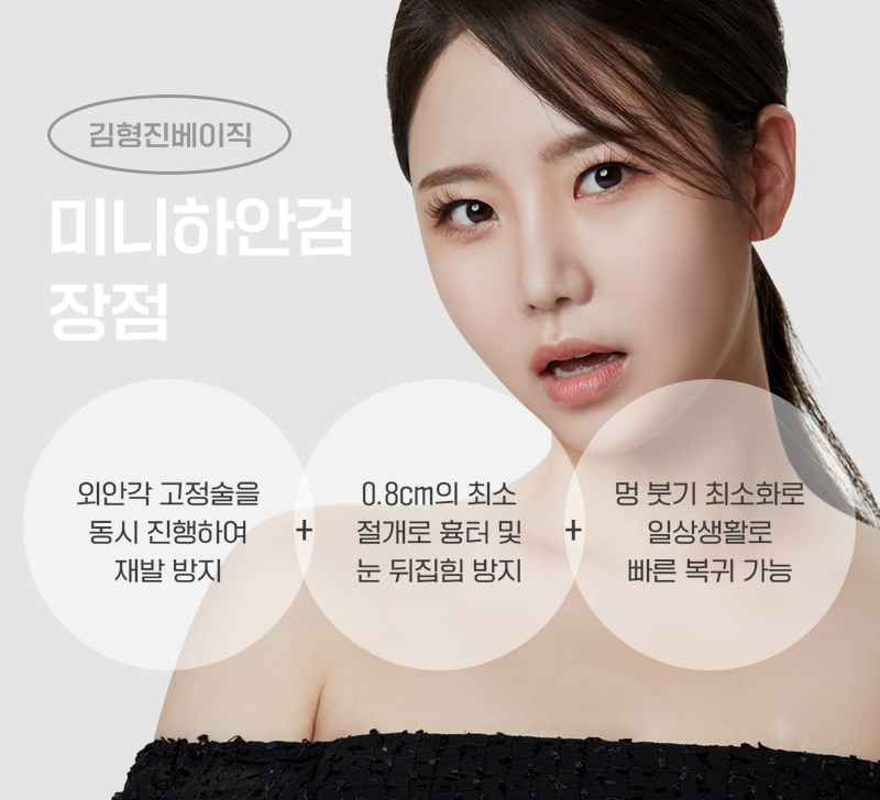 미니하안검 너무 괜찮죠? 관련 이미지 4