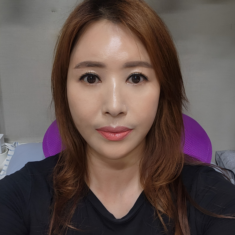 중년눈밑처짐수술 미니하안검으로 동안 인상 완성했어요! 관련 이미지 1