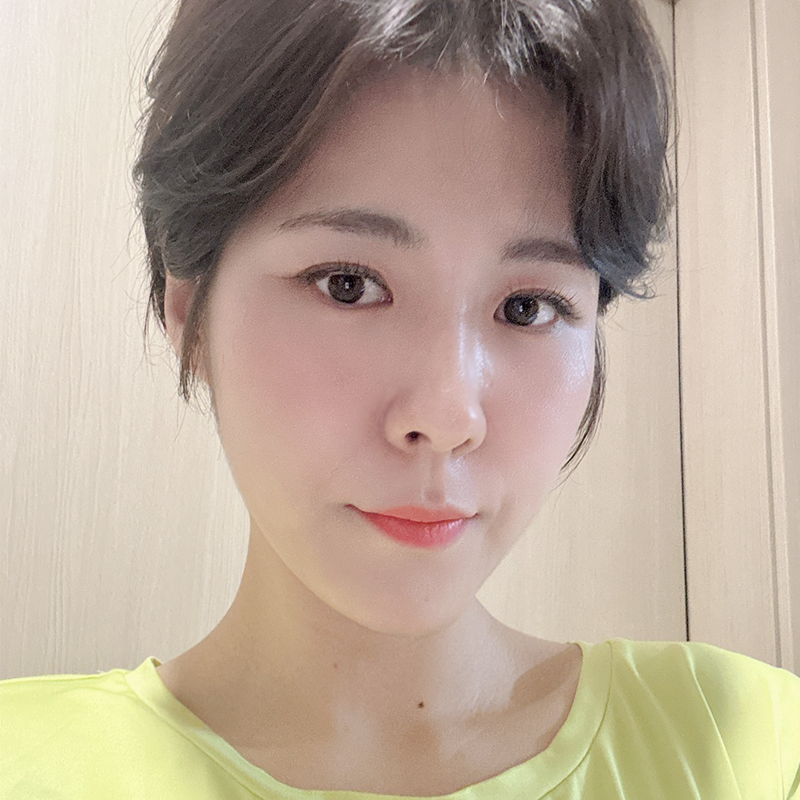 눈밑지방재배치재발 걱정되셨다구요? 관련 이미지 1