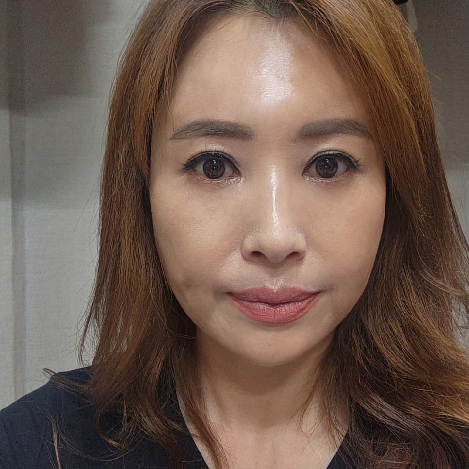 효도성형전후 보고 신중하게 결정했어요 관련 이미지 1