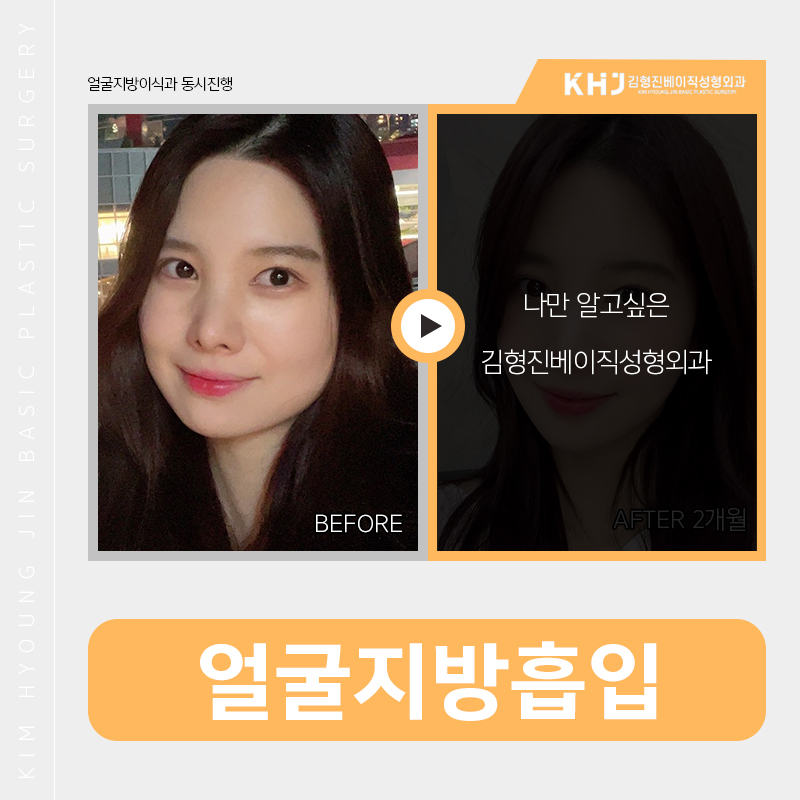 이중턱제거! 여기에요 김형진베이직! 관련 이미지 4