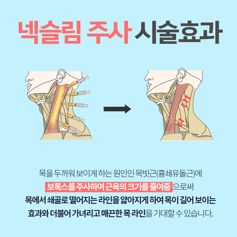 넥슬림주사후기 궁금하시죠? 관련 이미지 2