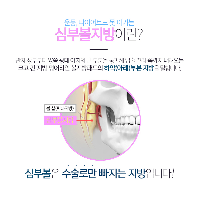 심부볼없애는법, 얼굴형이 매끄럽게 변했어요 관련 이미지 4
