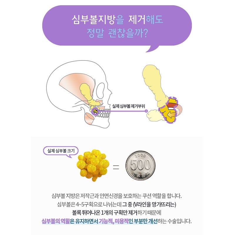 심부볼지방제거잘하는곳 돌고 돌아 여기네요 관련 이미지 6