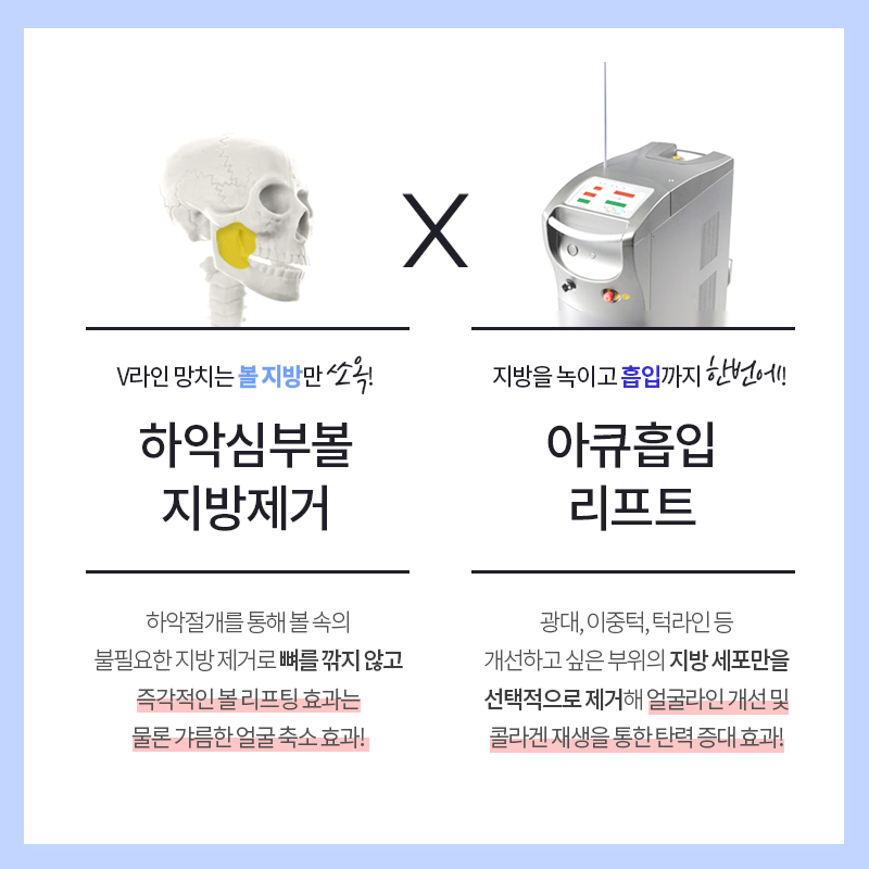 올해 가기 전에 얼굴살빼는수술 필요한 사람? 관련 이미지 4