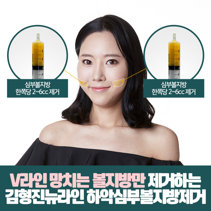 안면윤곽주사전후 보다 확실한걸 찾는다면 관련 이미지 4