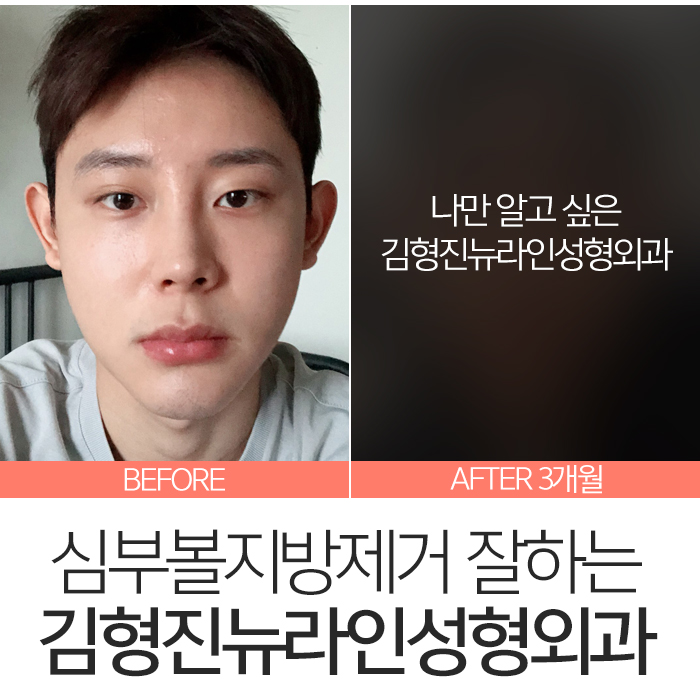 심부볼만 했어요 관련 이미지 8