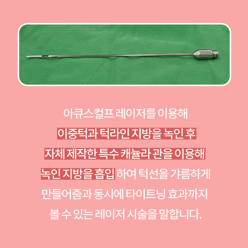 이중턱없애는법 겨우 찾았어요... 관련 이미지 5