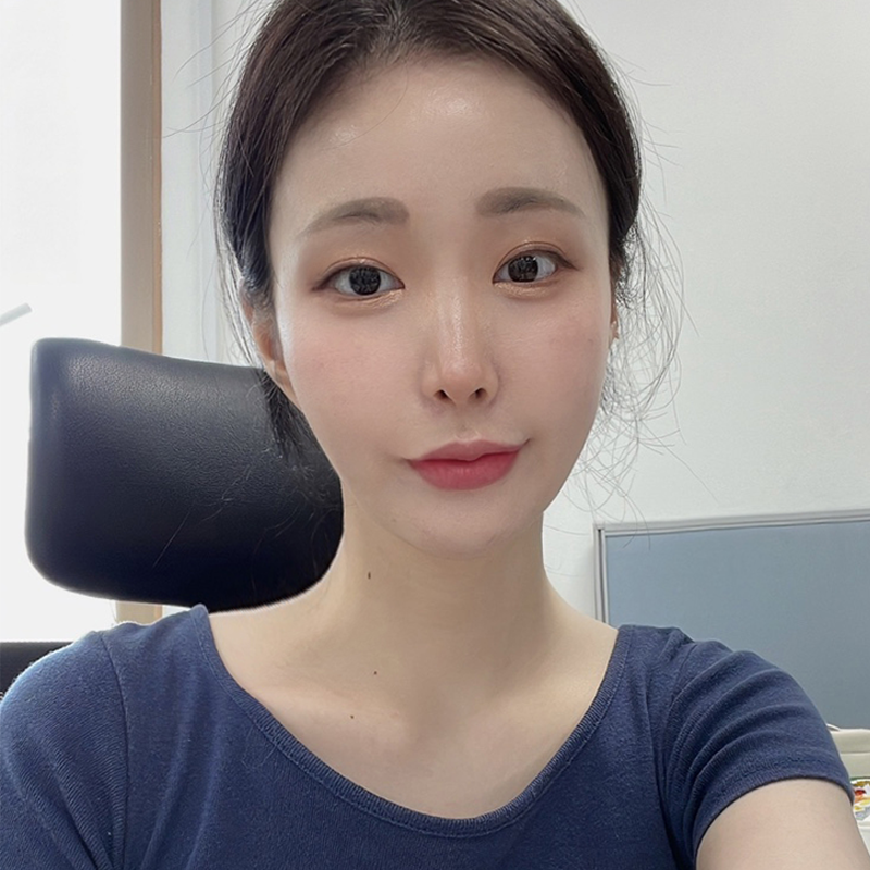 넥슬림주사효과 아직도 모르셨다면 관련 이미지 5