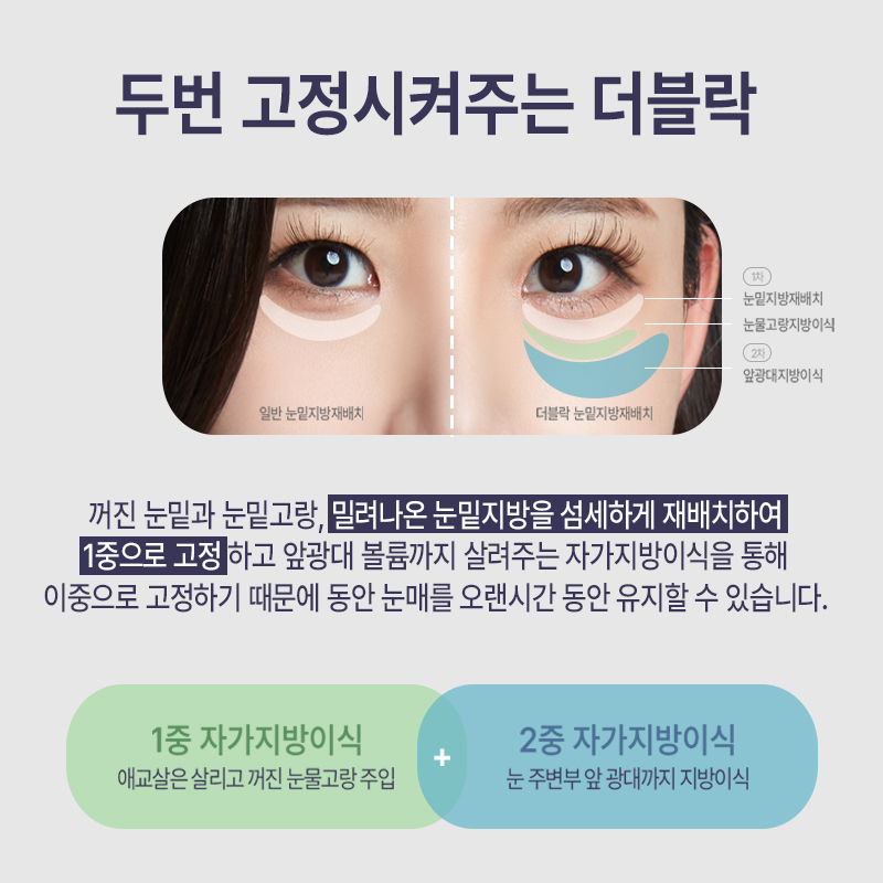눈밑다크서클 걱정하실필요 없어요! 관련 이미지 4
