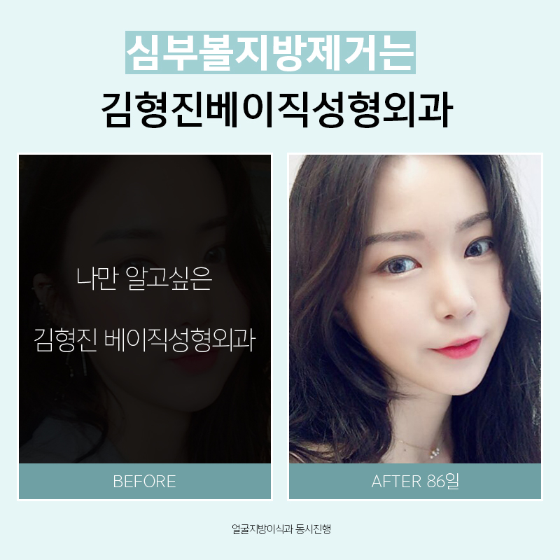 왜 하악심부볼이냐면요. 관련 이미지 5