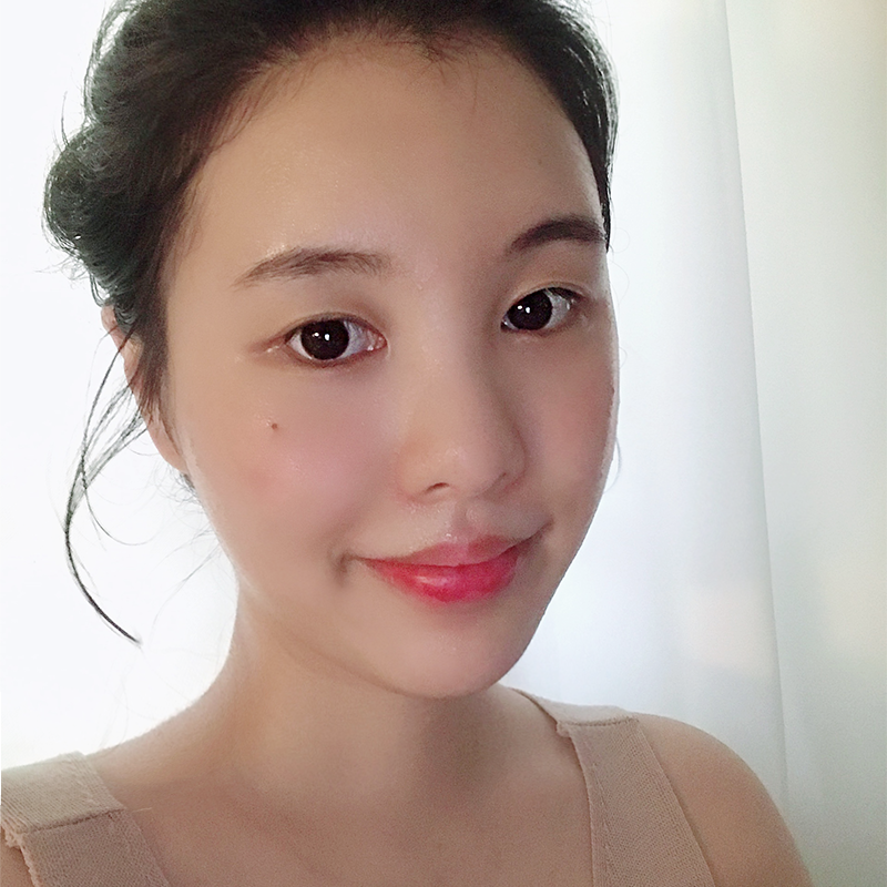 넥슬림주사효과 언제부터 볼 수 있냐면요 관련 이미지 1