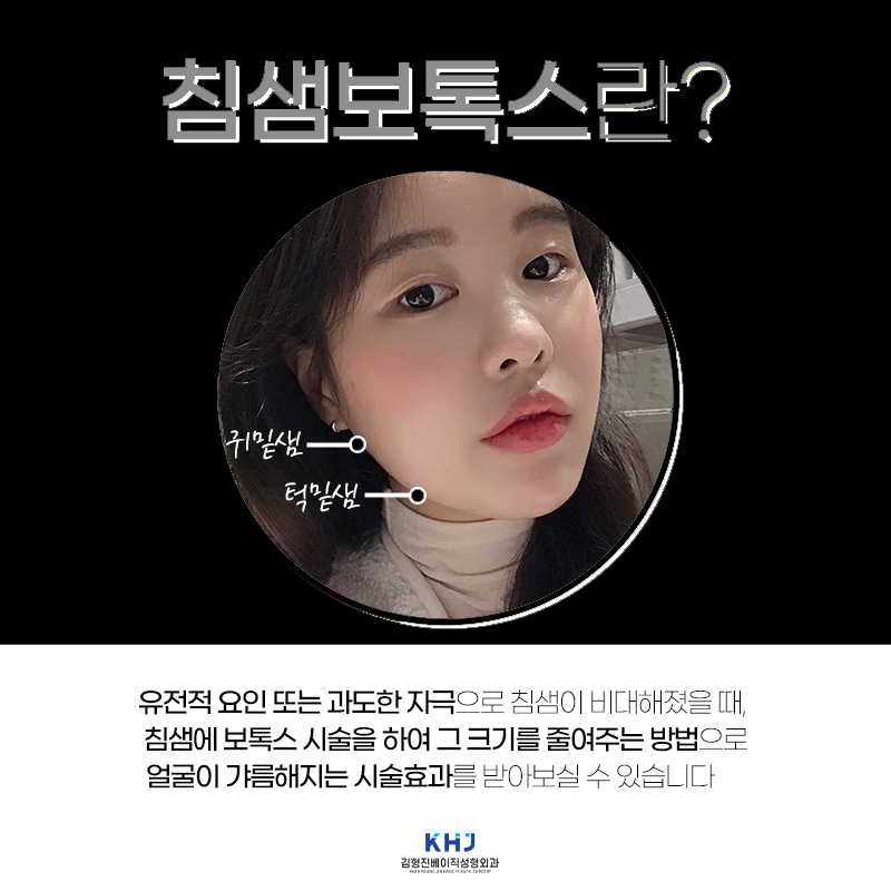 압구정침샘보톡스 맛집 찾아버렸습니다ㅠㅠ 관련 이미지 4