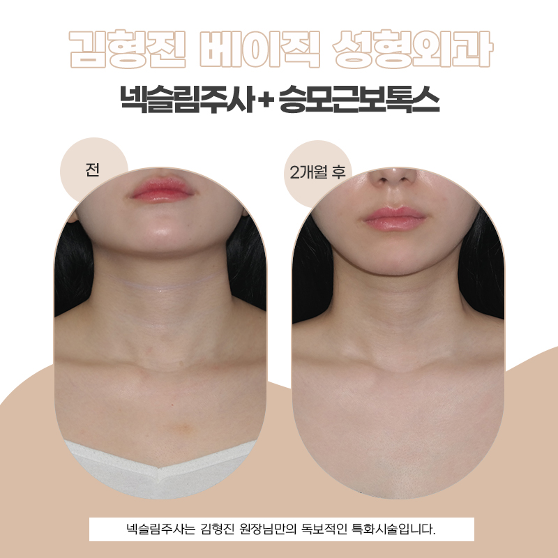 목얇아지는법 어떤 걸 해야할지 모르겠다면 관련 이미지 5