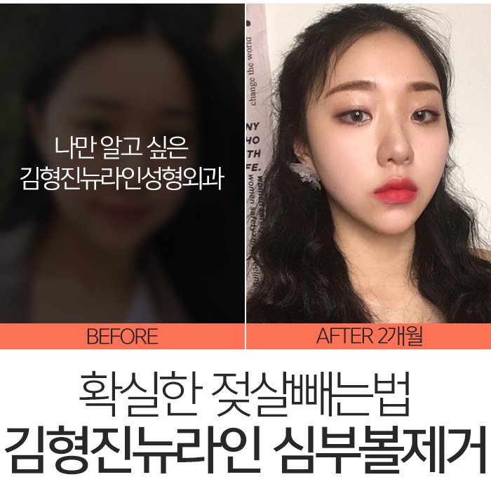 젖살빼는법 따로 있어요 관련 이미지 7