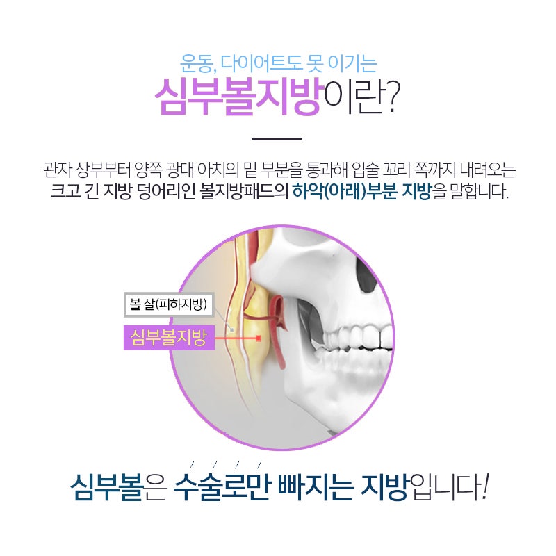 압구정심부볼제거는 김형진베이직에서 해야 하는 이유! 관련 이미지 4