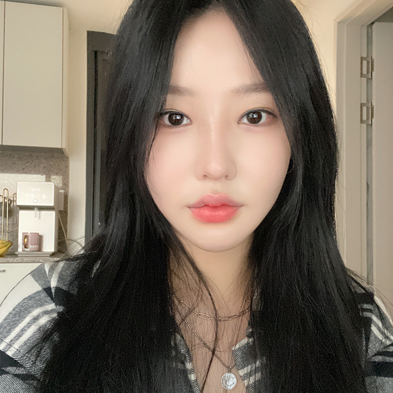 눈밑지방재배치잘하는병원 김형진베이직이죠! 관련 이미지 3