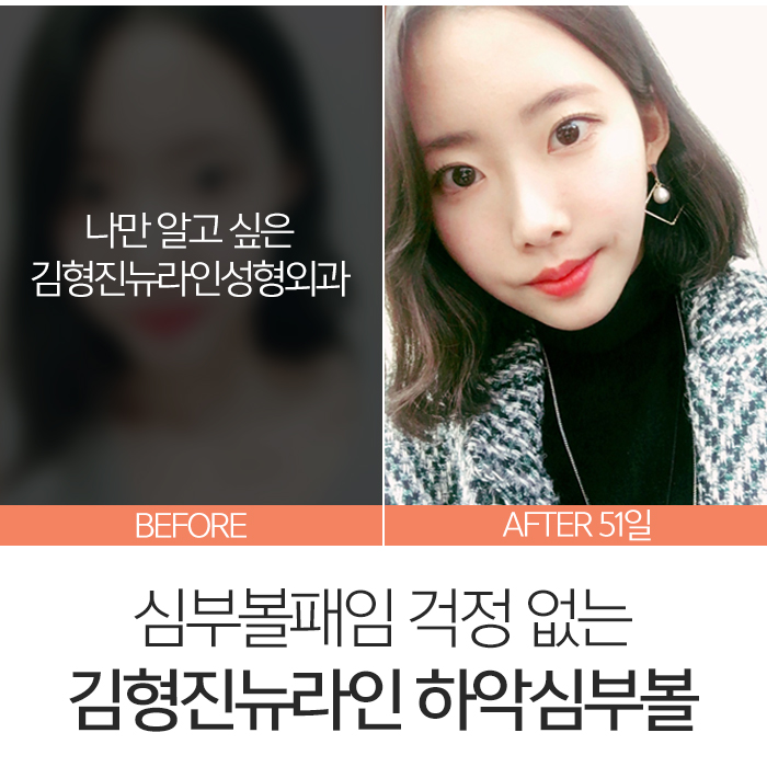 심부볼패임 어떻게 하느냐에 따라 달라요 관련 이미지 6