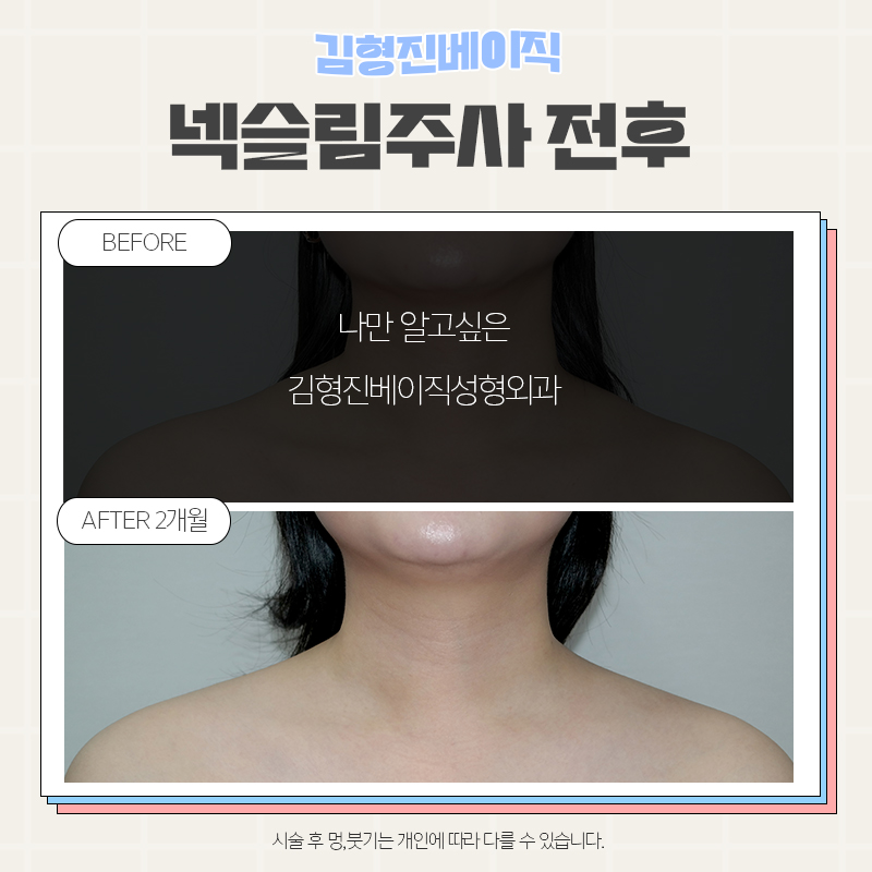 목얇아지는법 어렵지 않아요! 관련 이미지 5