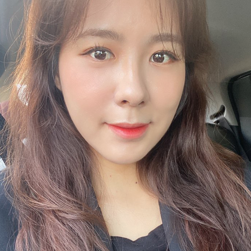 눈밑지방재배치잘하는병원 김형진베이직이죠! 관련 이미지 6