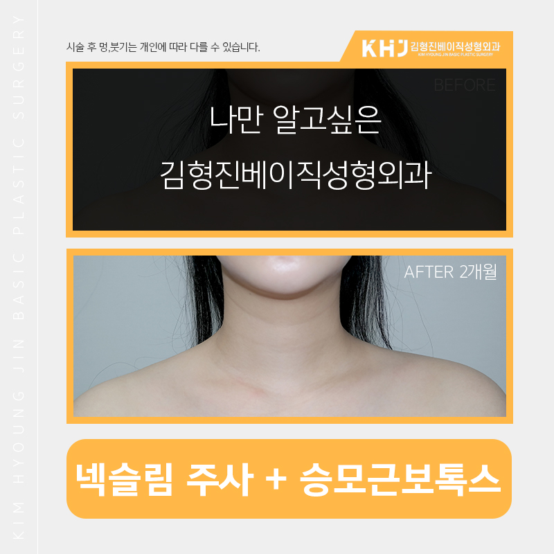 두꺼운목 해결은 넥슬림주사로 관련 이미지 3