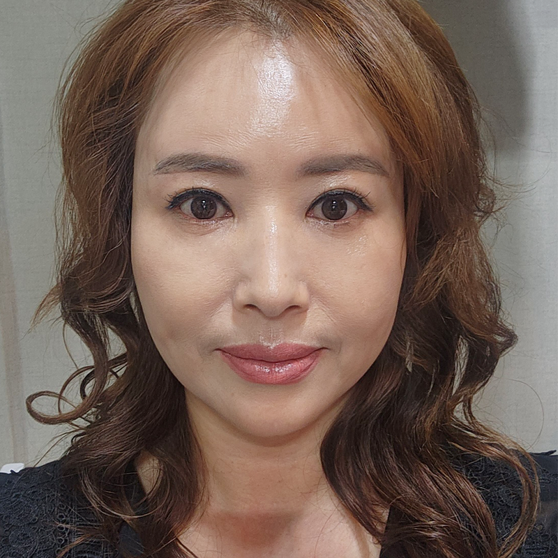 중년눈밑성형 아직도 고민하신다면 관련 이미지 1