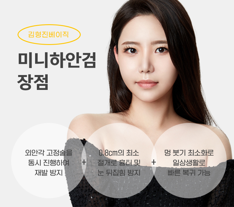 미니하안검전후 비교해보고 결정하세요! 관련 이미지 3