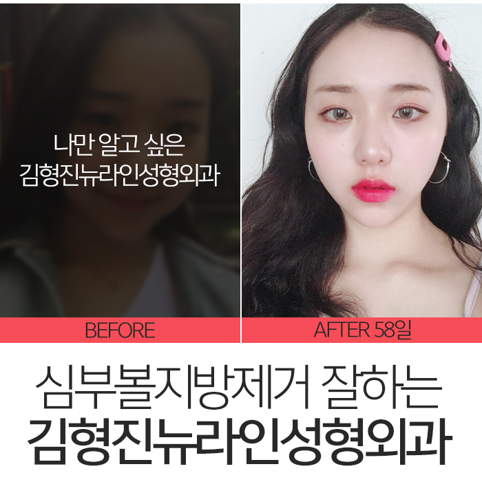 심부볼가격 아직도 싼 곳만 찾아요? 관련 이미지 3