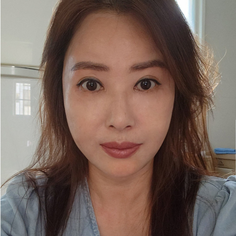 중년눈밑성형 전에 무조건 이걸 알고 가셔야 합니다! 관련 이미지 1