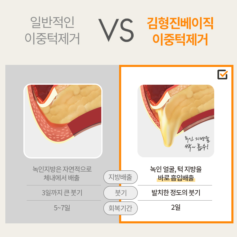 이중턱지방흡입비용 부담되신다구요? 관련 이미지 6