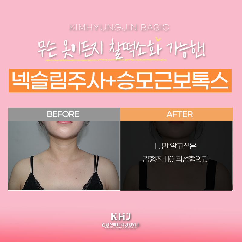 웨딩관리로 입소문 난 시술 궁금하셨다면? 관련 이미지 4