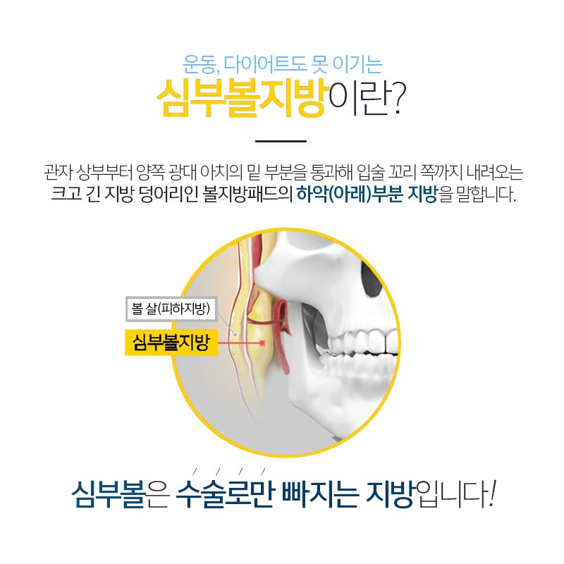 심부볼리프팅 해도 소용없다가 제거하고 광명 찾았어요 관련 이미지 4