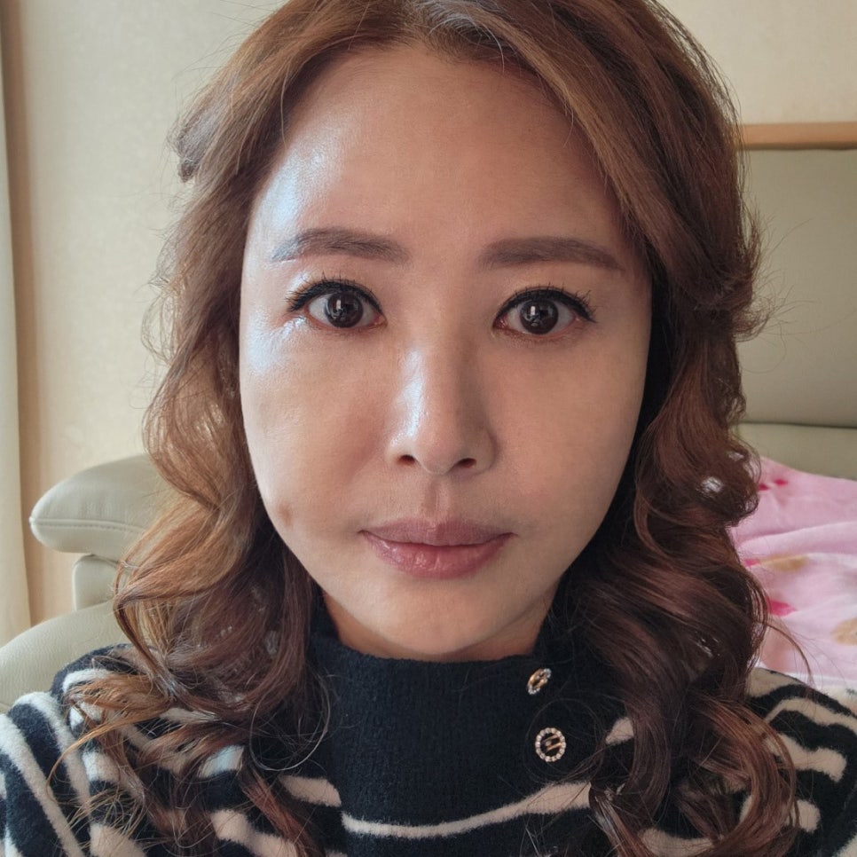 효도성형추천 변화가 확실한 김형진베이직의 미니하안검 관련 이미지 2