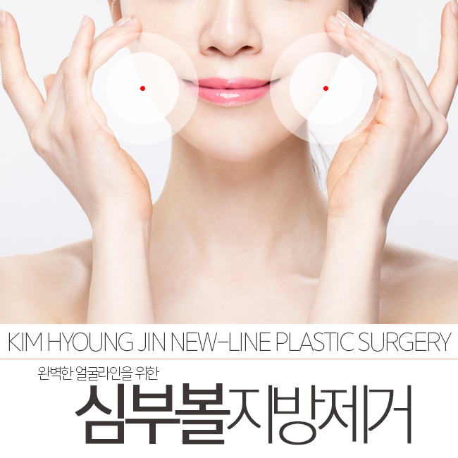 심부볼지방제거, 나만알고 싶은 곳 공개할께요! 관련 이미지 1
