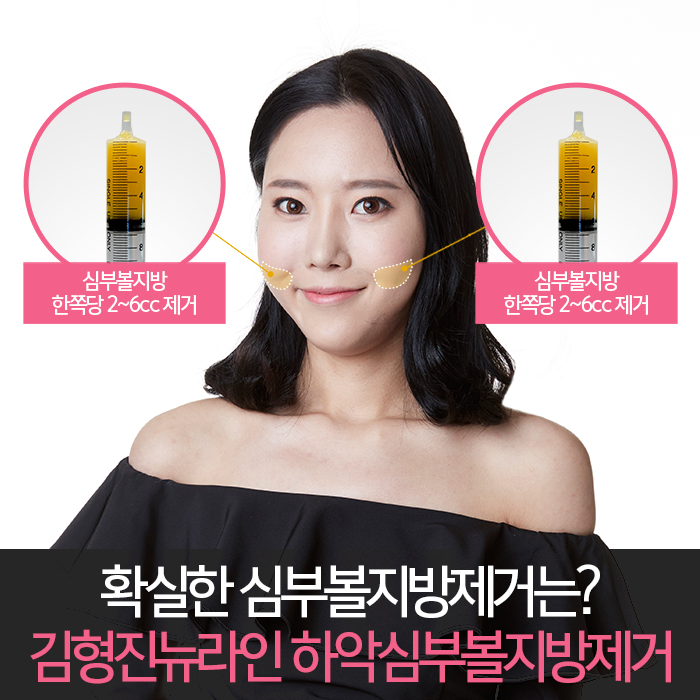 심부볼주사 이걸론 절대 못 빼요 관련 이미지 5