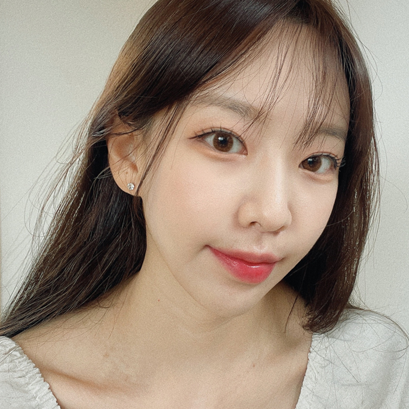 입꼬리필러리터치 김형진에서 하는 이유는요 관련 이미지 4